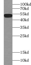 ESR2 antibody|ESR2抗体 FNab02866