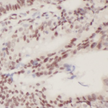 PLK3 antibody|PLK3抗体