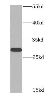MTAP antibody|MTAP抗体