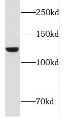 FNDC3A antibody|FNDC3A抗体