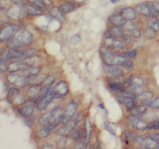 PKM2-specific antibody|PKM2抗体 