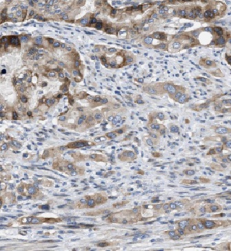 USH1C antibody|USH1C抗体 FNab037