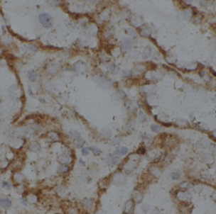 HSD11B2 antibody|HSD11B2抗体