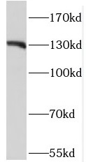 OGA antibody|OGA抗体 FNab05163