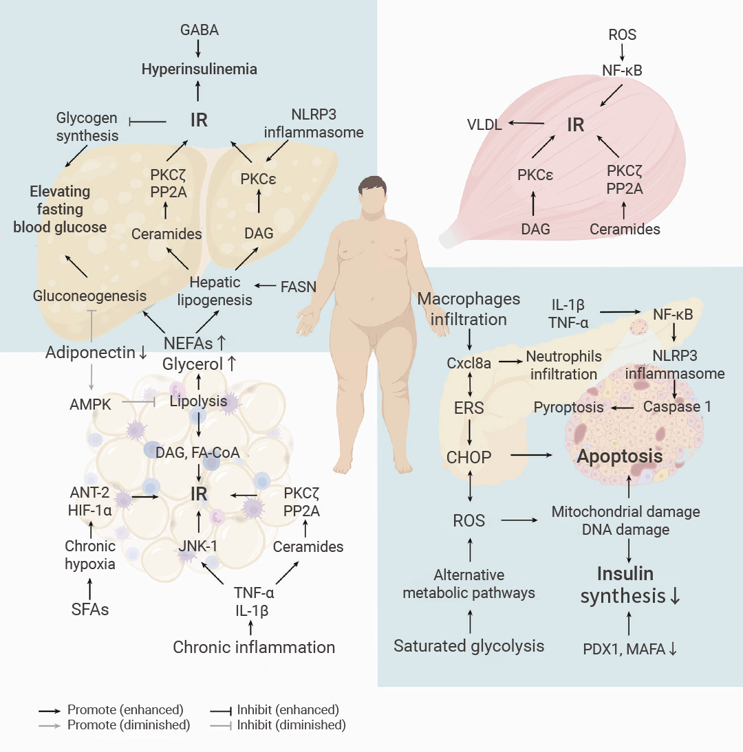 科研助攻 ｜ 2 型糖尿病∶ 机制、治疗策略和建模方法