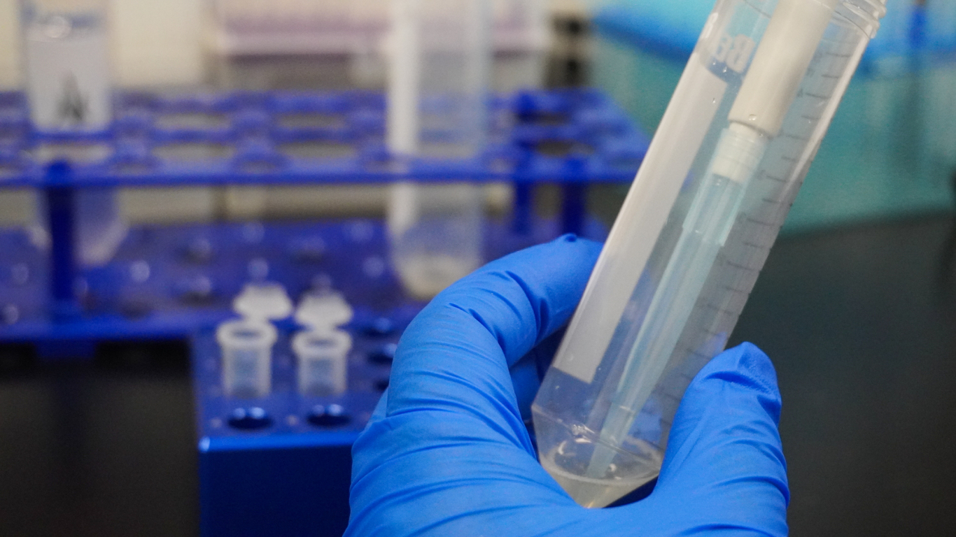 尿液/尿沉渣核酸提取试剂盒（磁珠法）