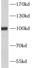 PCDH15 antibody|PCDH15抗体 FNab1