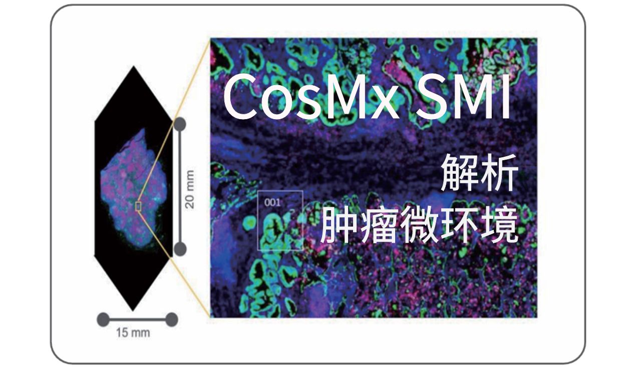 【IF：29】CosMx SMI解析胰腺癌耐药难题