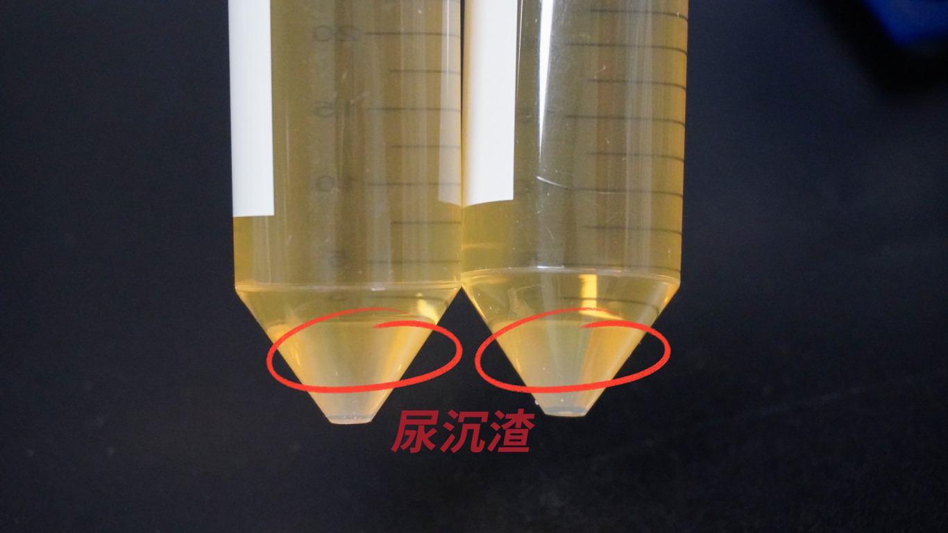 尿液/尿沉渣核酸提取试剂盒（磁珠法）