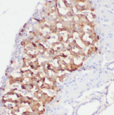 OGA antibody|OGA抗体 FNab05163