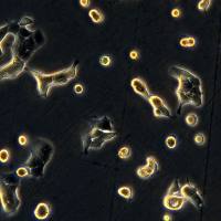 浙江美森-人非小细胞肺癌细胞系 NCI-H322