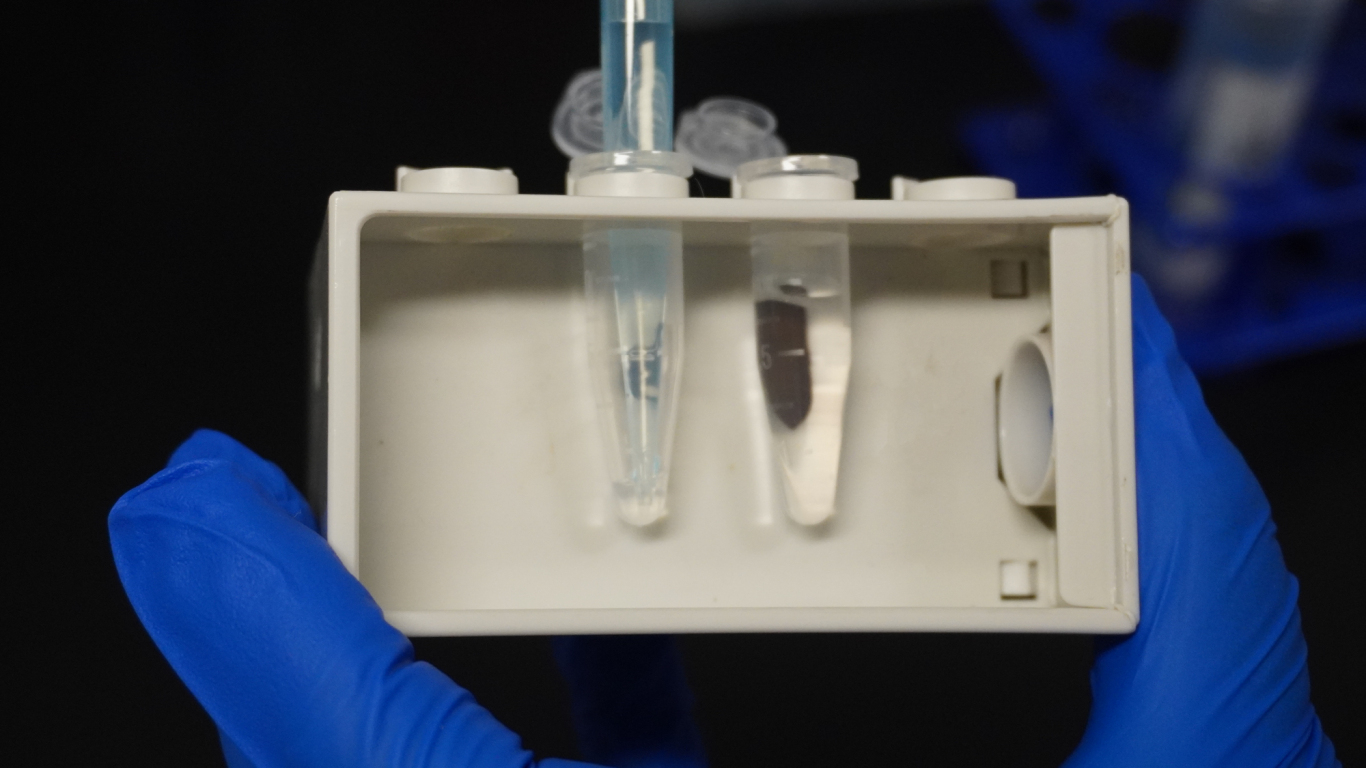 尿液/尿沉渣核酸提取试剂盒（磁珠法）