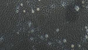 大鼠原代心脏微血管内皮细胞