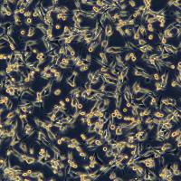 浙江美森-人黑素瘤细胞WM-266-4