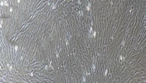 大鼠原代胸主动脉平滑肌细胞