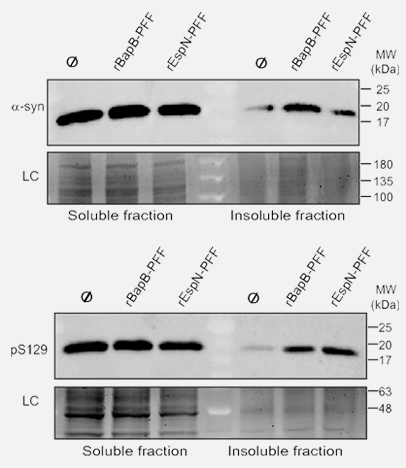 肠道微生物群导致神经退行性疾病？