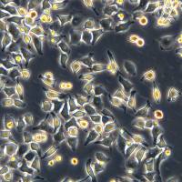 浙江美森-宫颈癌细胞H1Hela