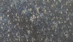 大鼠原代主动脉瓣膜间质细胞