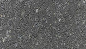 大鼠原代股骨头微血管内皮细胞