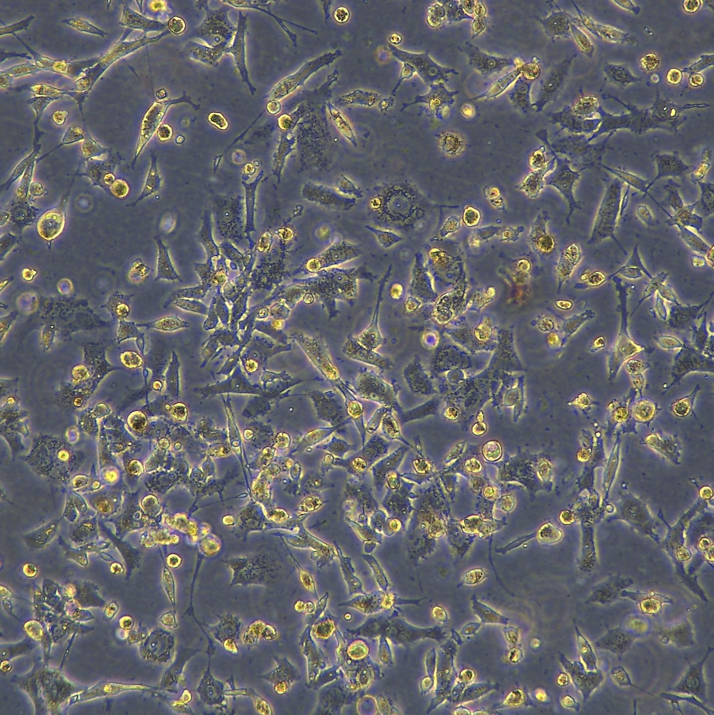 浙江美森-杂交细胞系1.1B4通过用胰腺癌细胞系PANC-1电融合胰岛的原代培养物而形成。1.1B4现货浙江美森