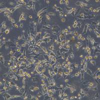 浙江美森-杂交细胞系1.1B4通过用胰腺癌细胞系PANC-1电融合胰岛的原代培养物而形成。1.1B4现货浙江美森