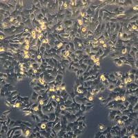 浙江美森-膀胱癌细胞KU1919