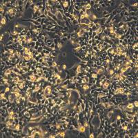 浙江美森-小鼠神经胶质瘤细胞 glioma261