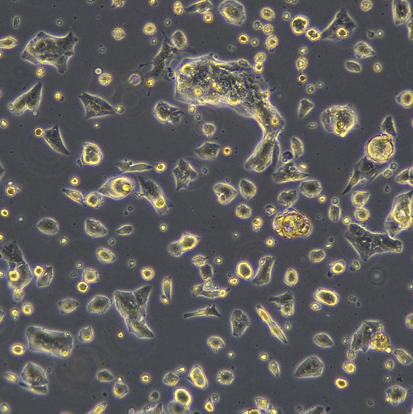 浙江美森-舌头鳞癌细胞 UPCISCC090