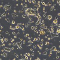 浙江美森-舌头鳞癌细胞 UPCISCC090