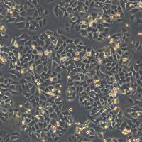 浙江美森-肺癌细胞(非小细胞)HCC15