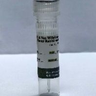 （内皮标志物抗体）Anti-Von Willebrand Factor Rabbit mAb