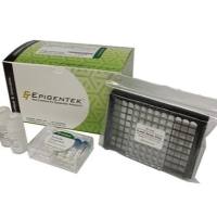 EpiQuik m6A RNA Methylation Quantification Kit (Colorimetric)