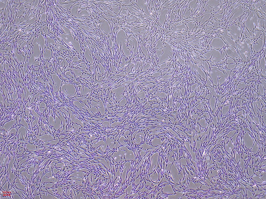 一手数据：人诱导间充质干细胞形态-hiMSCs（P1-P9）