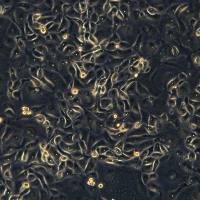 浙江美森-子宫内膜癌细胞EFE184