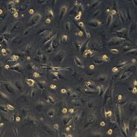 浙江美森-乳腺癌细胞CAL120