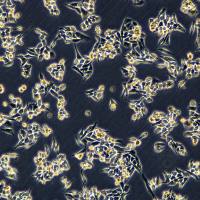 浙江美森-人子宫内膜腺癌(转移)细胞AN3 CA