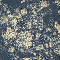 浙江美森-乳腺癌细胞KPL4