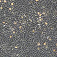 浙江美森-口腔鳞癌细胞PECAPJ41