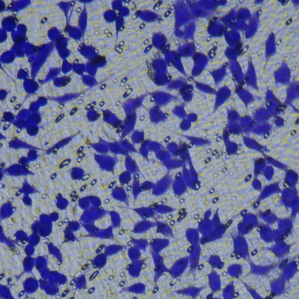 细胞功能检测/细胞迁移 细胞Transwell实验