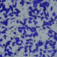 细胞功能检测/细胞迁移 细胞Transwell实验