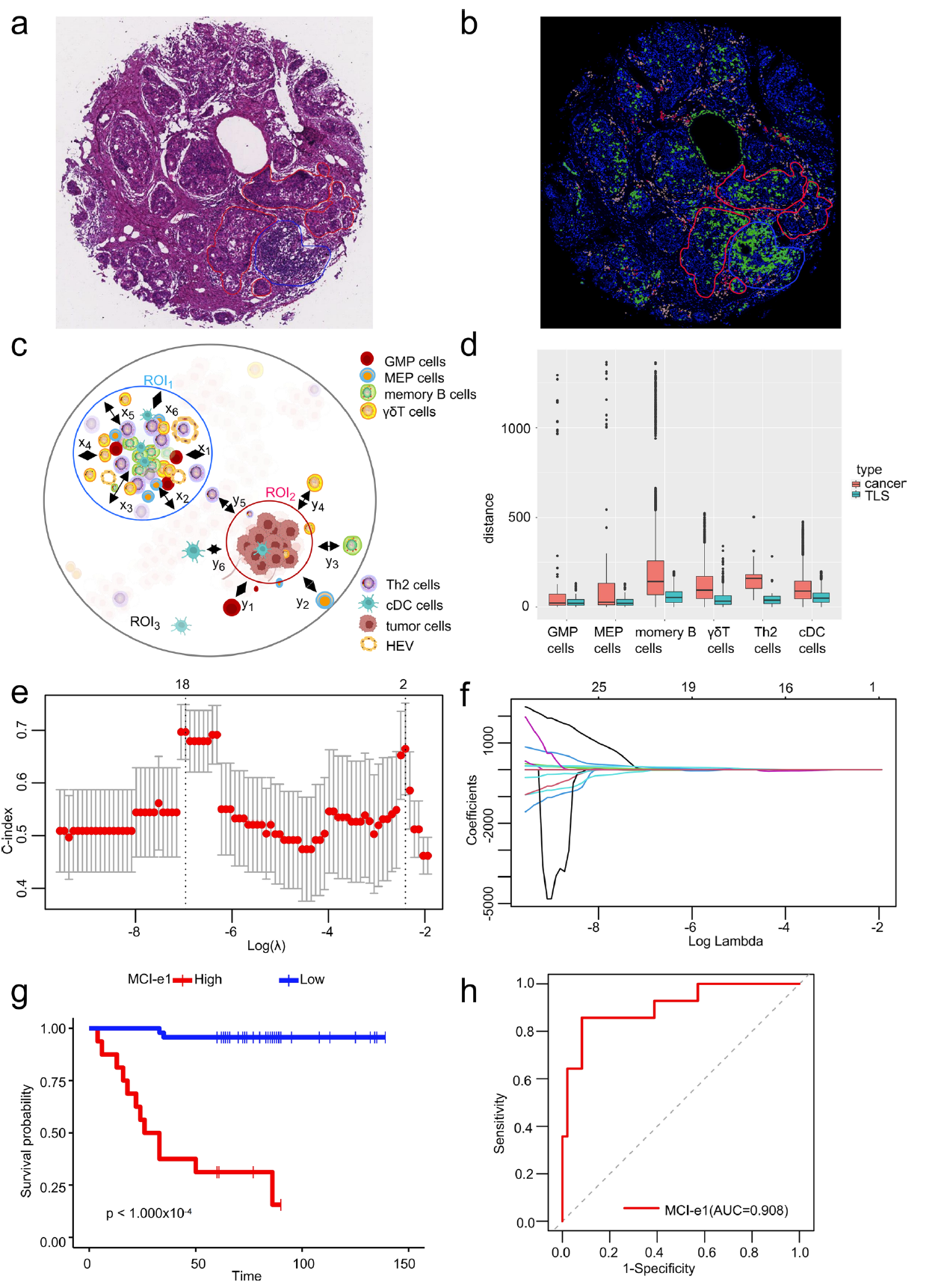 Tissue Cytometry技术解码三阴性乳腺癌微环境细胞空间分布，为精准诊疗注入新动力