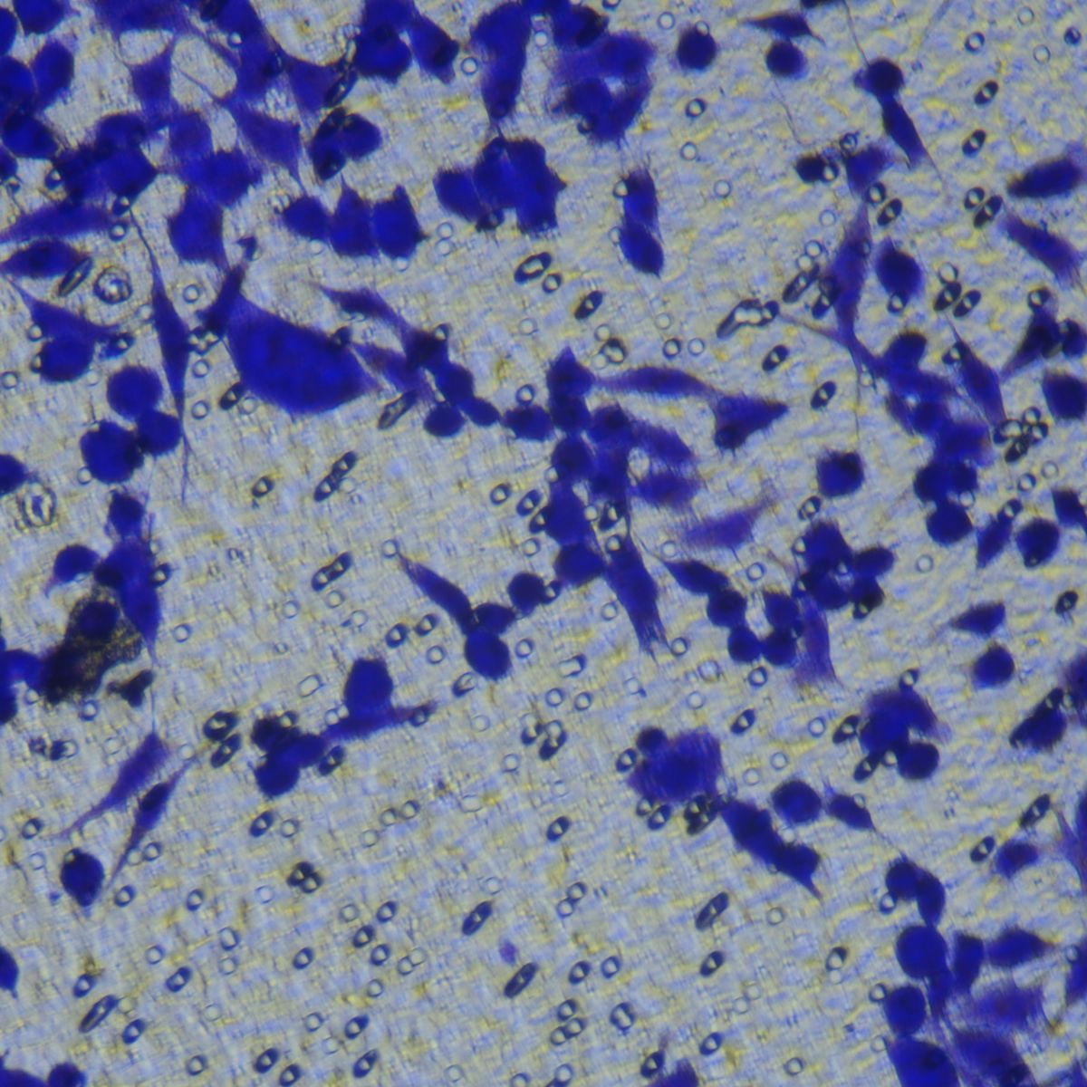 细胞功能检测/细胞侵袭细胞Transwell实验