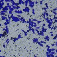 细胞功能检测/细胞侵袭细胞Transwell实验