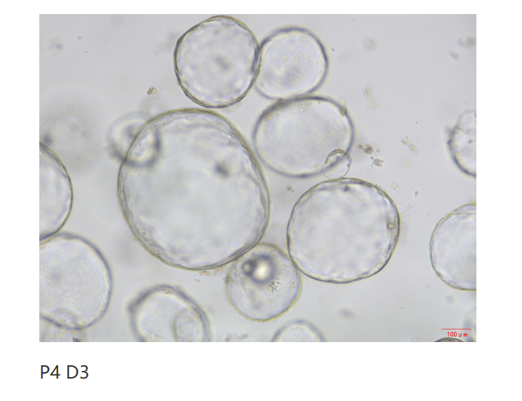 小鼠胆管类器官的体外构建：核心生长因子与信号通路的精密调控