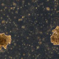 浙江美森-霍奇金淋巴瘤细胞Hs 611.T