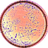 细胞功能检测|平板克隆形成实验