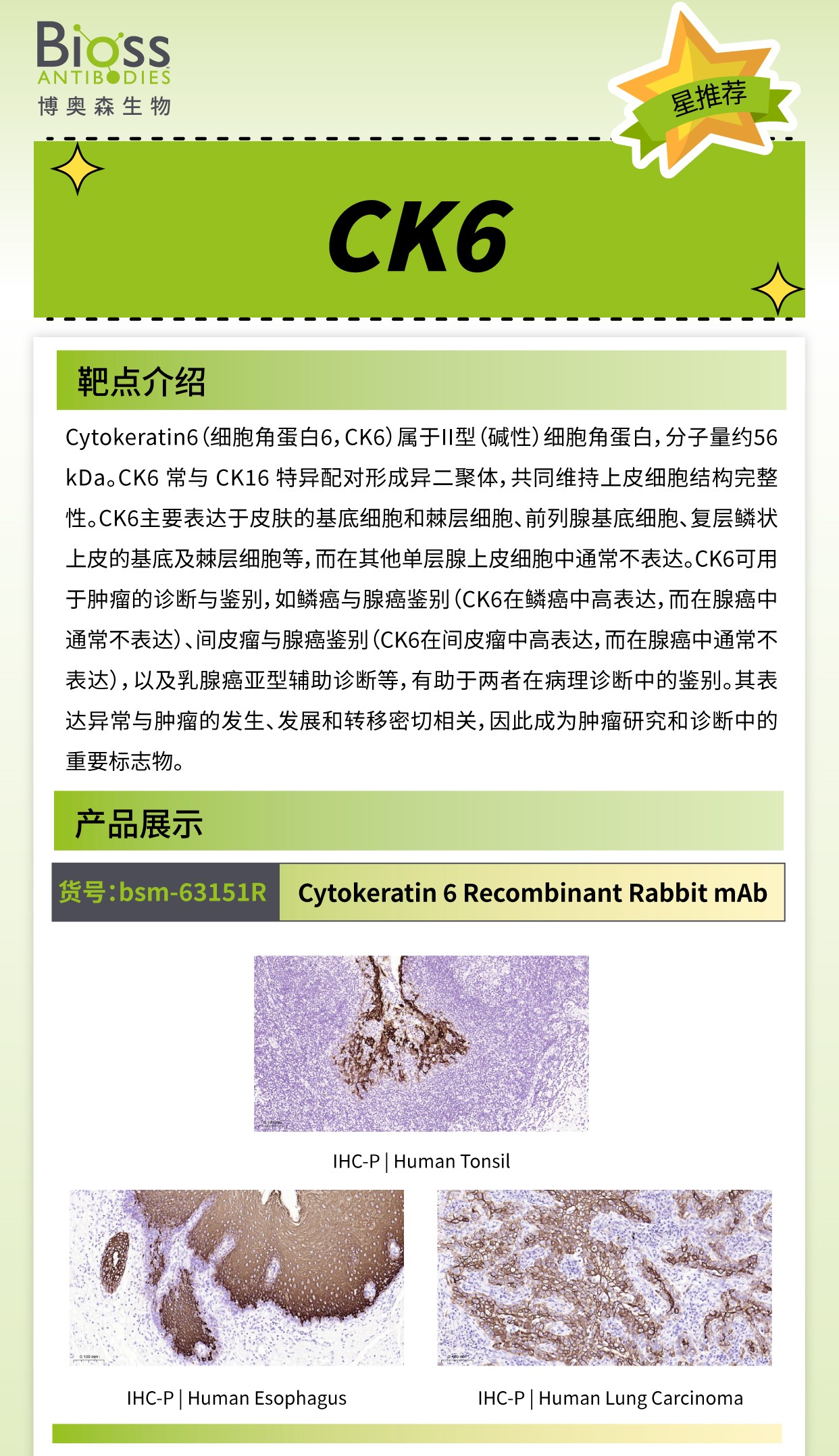 Bioss 星推荐 | CK6 抗体