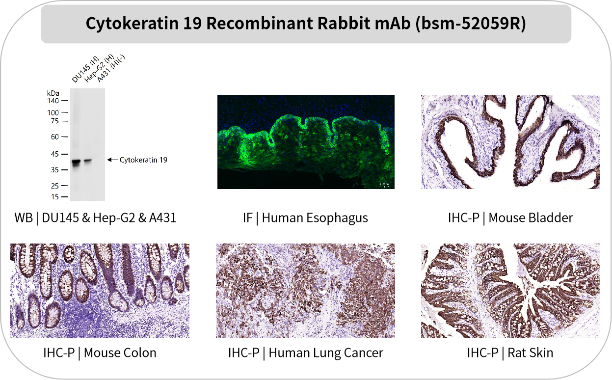 Bioss 爆品推荐 | 谁是“上皮组织”的忠实管家？CK抗体：找我，准没错！