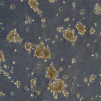 浙江美森-人卵巢癌细胞株COC1