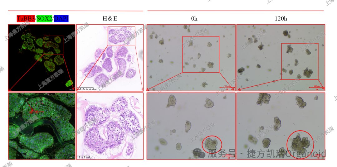 国内首家非IPSC来源脑类器官上新及脑类器官应用